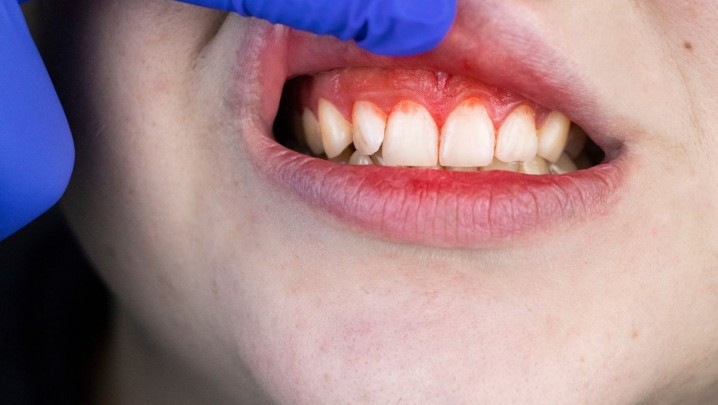 Periodontologia Clínica Rio Este